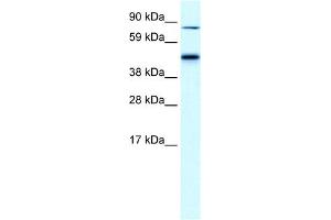 WB Suggested Anti-EPB42 Antibody Titration:  0. (EPB42 anticorps  (Middle Region))