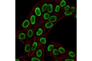 Immunofluorescent staining of paraformaldehyde-fixed HeLa cells using Histone H1 Rabbit Recombinant Monoclonal Antibody (HH1/1784R) followed by goat anti-rabbit IgG-CF488 (Green).