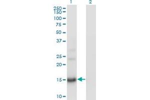 Western Blot analysis of BTG2 expression in transfected 293T cell line by BTG2 monoclonal antibody (M01), clone 1A5. (BTG2 anticorps  (AA 59-158))