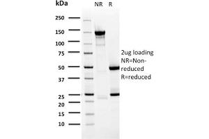 SDS-PAGE Analysis Purified BARX1 Mouse Monoclonal Antibody (BARX1/2759). (BARX1 anticorps  (AA 155-254))