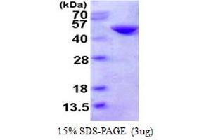SDS-PAGE (SDS) image for Cystathionase (Cystathionine gamma-Lyase) (CTH) (AA 1-405) protein (His tag) (ABIN667632)