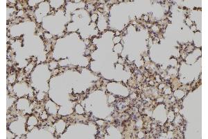 ABIN6279149 at 1/100 staining Mouse lung tissue by IHC-P. (ATXN7L3 anticorps  (Internal Region))