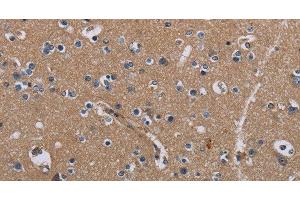 Immunohistochemistry of paraffin-embedded Human brain tissue using PIDD1 Polyclonal Antibody at dilution 1:30 (PIDD anticorps)