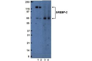Western blot analysis of SREBP-2. (SREBF2 anticorps  (AA 833-1141))