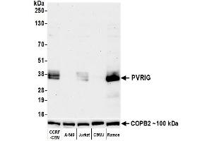 Western Blotting (WB) image for anti-Poliovirus Receptor-Related Immunoglobulin Domain Containing (PVRIG) (AA 200-250) antibody (ABIN7795700)