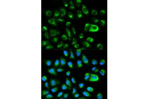 Immunofluorescence analysis of HeLa cells using GAS2 antibody (ABIN5970514).