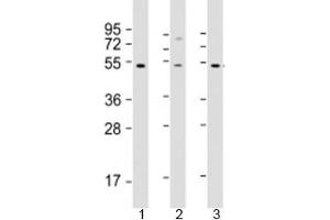 Western blot testing of human 1) HT-1080, 2) SH-SY5Y and 3) Y79 cell lysate with ZNF513 antibody at 1:2000. (ZNF513 anticorps  (AA 82-115))