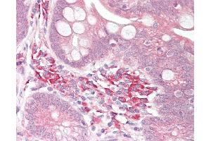 Anti-USP7 antibody IHC of human small intestine.