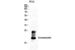Western Blot (WB) analysis of specific cells using Somatostatin Polyclonal Antibody. (Somatostatin anticorps  (N-Term))
