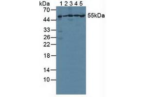 Figure. (PSMC1 anticorps  (AA 1-440))