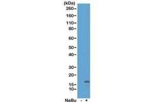 Western blot of acid extracts from HeLa cells untreated (-) or treated (+) with sodium butyrate using recombinant H3K18ac antibody at 0. (Recombinant Histone 3 anticorps  (acLys18))