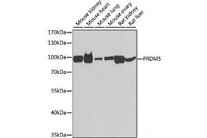 Western blot analysis of extracts of various cell lines using PRDM5 Polyclonal Antibody at dilution of 1:1000. (PRDM5 anticorps)