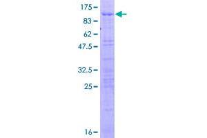 Image no. 1 for RNA Binding Motif Protein 39 (RBM39) (AA 1-524) protein (GST tag) (ABIN1317603)