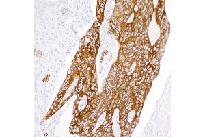 Immunohistochemistry (IHC) image for anti-Keratin 20 (KRT20) (AA 250-300) antibody (ABIN7453968)