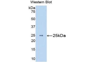 Western blot analysis of the recombinant protein. (Mannose Associated Serine Protease 2 (AA 22-142) anticorps)