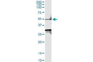 Immunoprecipitation of SMYD2 transfected lysate using anti-SMYD2 MaxPab rabbit polyclonal antibody and Protein A Magnetic Bead , and immunoblotted with SMYD2 purified MaxPab mouse polyclonal antibody (B01P) .
