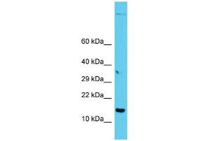 Host: Rabbit Target Name: GAGE12I Sample Type: PANC1 Whole Cell lysates Antibody Dilution: 1. (G Antigen 12I anticorps  (C-Term))