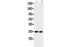 Anti-IL6 Picoband antibody,  All lanes: Anti-IL6 at 0. (IL-6 anticorps  (AA 25-211))