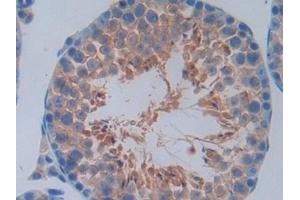 Detection of CCND2 in Mouse Testis Tissue using Polyclonal Antibody to Cyclin D2 (CCND2)
