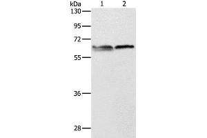 Western Blot analysis of 293T and Jurkat cell using ALAS2 Polyclonal Antibody at dilution of 1:1000 (ALAS2 anticorps)
