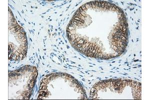 Immunohistochemical staining of paraffin-embedded Human liver tissue using anti-BSG mouse monoclonal antibody. (CD147 anticorps)