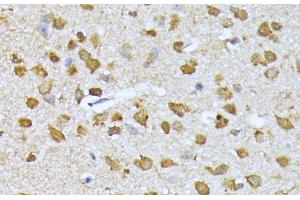 Immunohistochemistry of paraffin-embedded Mouse brain using RPS27A Polyclonal Antibody at dilution of 1:100 (40x lens).
