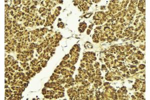 ABIN6268923 at 1/100 staining Mouse pancreas tissue by IHC-P. (TRAF6 anticorps  (Internal Region))