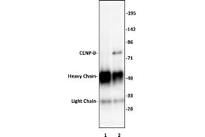 CENP-B antibody (pAb) tested by Immunoprecipitation. (CENPB anticorps  (C-Term))