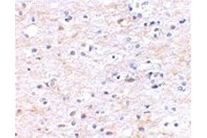 Immunohistochemical staining of human brain tissue using FNBP1L polyclonal antibody  at 2. (FNBP1L anticorps  (N-Term))