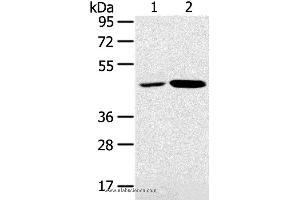 Western blot analysis of K562 and Jurkat cell, using SNX5 Polyclonal Antibody at dilution of 1:250 (SNX5 anticorps)
