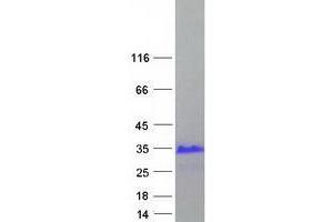 Validation with Western Blot