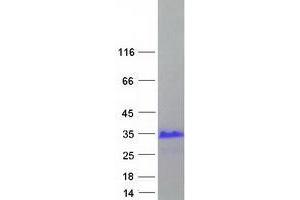 Validation with Western Blot (X Antigen Family, Member 3 (XAGE3) (Transcript Variant 1) protein (Myc-DYKDDDDK Tag))