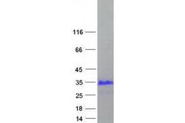 X Antigen Family, Member 3 (XAGE3) (Transcript Variant 1) protein (Myc-DYKDDDDK Tag)