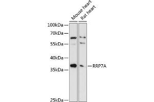 Western blot analysis of extracts of various cell lines, using RRP7A antibody (ABIN6133010, ABIN6147275, ABIN6147276 and ABIN6225048) at 1:3000 dilution. (RRP7A anticorps  (AA 1-280))