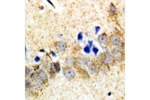 Immunohistochemical analysis of Carboxypeptidase A6 staining in rat brain  formalin fixed paraffin embedded tissue section. (CPA6 anticorps)