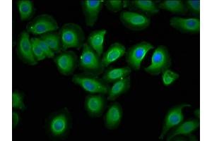 Immunofluorescence staining of A549 cells with ABIN7151731 at 1:133, counter-stained with DAPI.