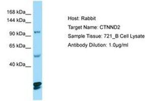 Image no. 1 for anti-Catenin (Cadherin-Associated Protein), delta 2 (Neural Plakophilin-Related Arm-Repeat Protein (CTNND2) (AA 1066-1115) antibody (ABIN6749992) (CTNND2 anticorps  (AA 1066-1115))