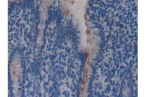 IHC-P analysis of Rat Intestine Tissue, with DAB staining.