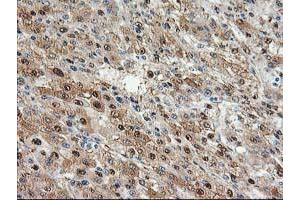 Image no. 1 for anti-Aminoacylase 1 (ACY1) antibody (ABIN1496453) (Aminoacylase 1 anticorps)