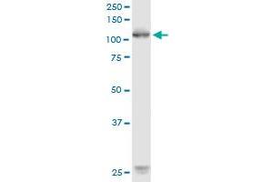 ROR1 monoclonal antibody (M02), clone 1B4.