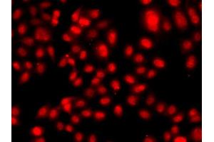 Immunofluorescence analysis of A549 cells using TEAD3 antibody (ABIN5975292). (TEAD3 anticorps)