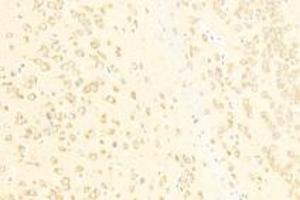 Immunohistochemistry analysis of paraffin-embedded mouse substantia nigra using ADAMTS4 (ABIN7072947) at dilution of 1: 500