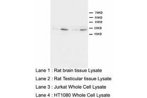 Image no. 1 for anti-High Mobility Group Box 4 (HMGB4) (N-Term) antibody (ABIN1495045) (HMGB4 anticorps  (N-Term))