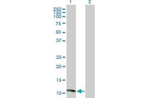 Western Blot analysis of MGP expression in transfected 293T cell line by MGP MaxPab polyclonal antibody.