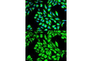Immunofluorescence analysis of HeLa cells using EEF1A1 antibody. (eEF1A1 anticorps)