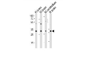 Western blot analysis of lysates from human brain, mouse brain, mouse cerebellum, rat brain tissue (from left to right), using PCGF1 Antibody (Center) (ABIN6242736 and ABIN6577728). (PCGF1 anticorps  (AA 117-151))