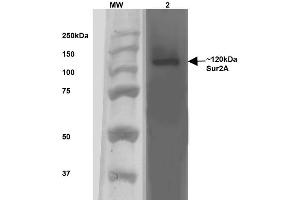 Western Blot analysis of Rat Brain Membrane showing detection of ~120 kDa SUR2A protein using Mouse Anti-SUR2A Monoclonal Antibody, Clone S319A-14 . (ABCC9 anticorps  (AA 1505-1546) (HRP))