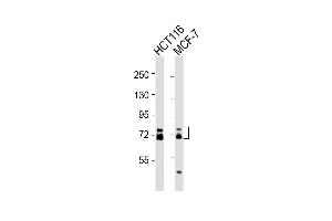 All lanes : Anti-ESRP1 Antibody (N-term) at 1:2000 dilution Lane 1: HC whole cell lysates Lane 2: MCF-7 whole cell lysates Lysates/proteins at 20 μg per lane. (ESRP1 anticorps  (AA 182-211))