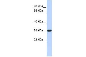 WB Suggested Anti-SDHB Antibody Titration:  0. (SDHB anticorps  (Middle Region))