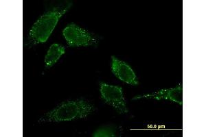 Immunofluorescence of monoclonal antibody to CBR3 on HeLa cell.